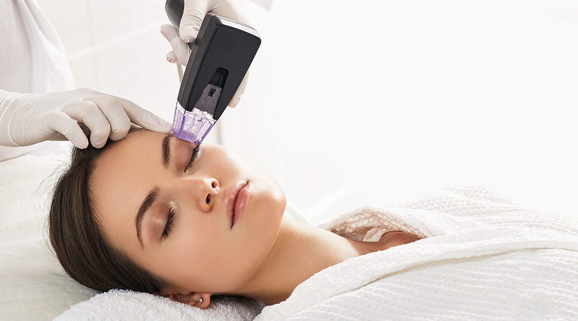 Morpheus8 microneedling treatment